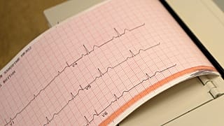 Emoji eines Elektrokardiogramms