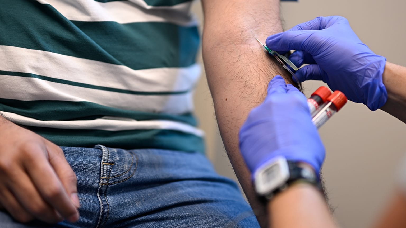 تم سحب عينة دم من فرناندو هيرميدا لإجراء الفحوصات خلال زيارته لعيادة باين آبل هيلثكير الطبية في أورلاندو، فلوريدا، يوم الثلاثاء 28 مايو 2024. (صورة من وكالة أسوشيتد برس/فيلان)