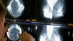 Investigaciones contra el cáncer, imagen de archivo