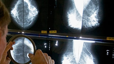 Badania nad rakiem, zdjęcie archiwalne