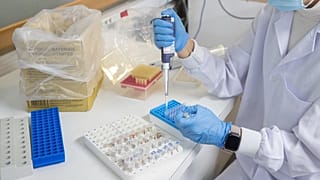 Im Virologielabor der Universität für Tropenmedizin arbeitet ein Forscher an der Entwicklung eines Tests.