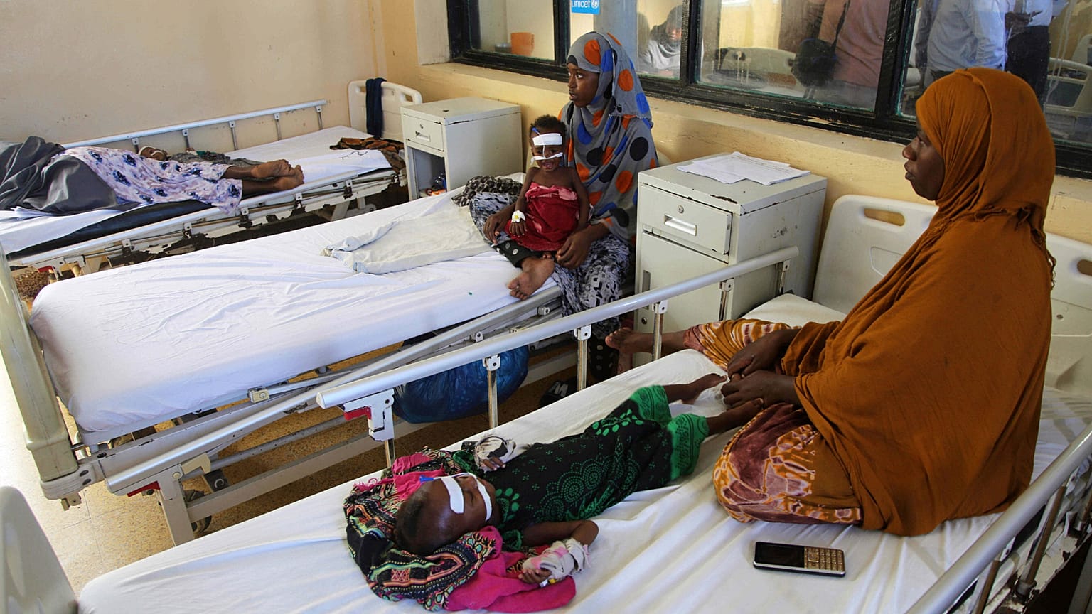 Illusztráció: éhezés miatt legyengült gyerekek egy szomáliai kórházban, 2025