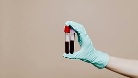 New blood test may predict who is most likely to live longer, study finds