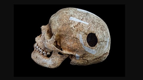 Cambridge'de 'dev' keşif: 1200 yıllık toplu mezarda kafatası delinmiş bir dev bulundu