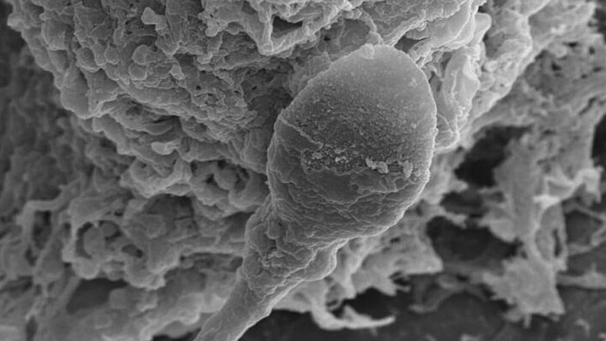 Spermler uzayda kayboluyor: Yerçekimsiz ortamda hamilelik mümkün olmayabilir