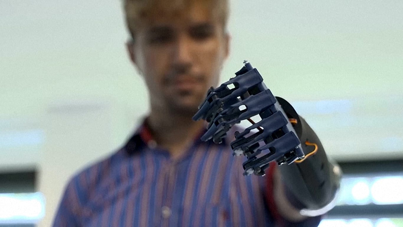 Video. How a childhood friendship led to a breakthrough bionic arm ...