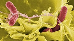 Salmonella bakterisi