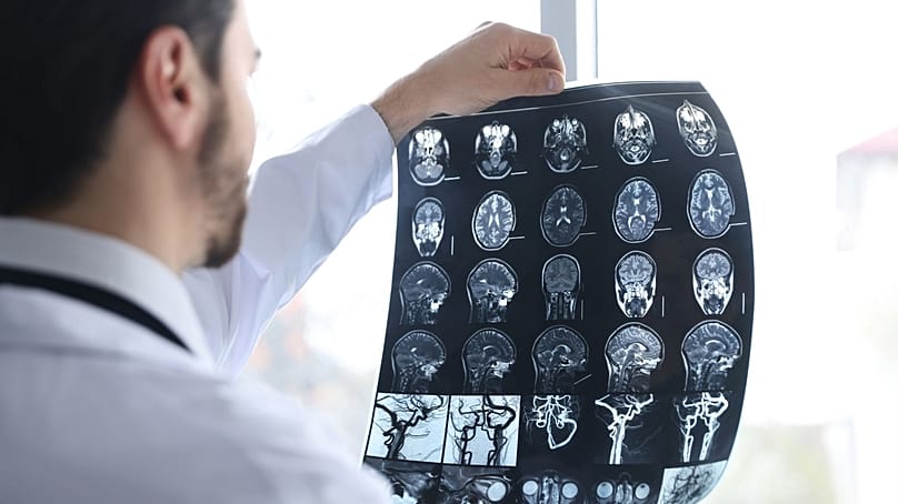 طبيب يفحص صوراً إشعاعية للدماغ