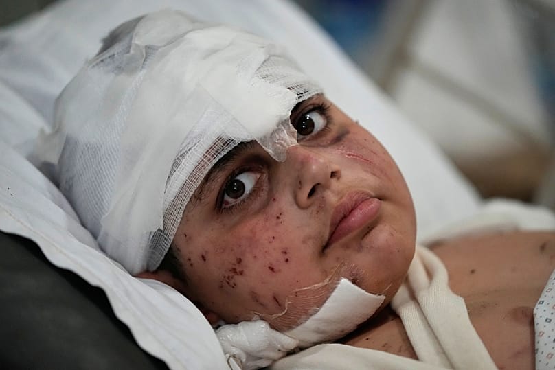 علي سلمان، 12 عاماً، الذي أصيب في غارة جوية إسرائيلية، يرقد على سرير في مستشفى جبل أمل بمدينة صور الساحلية الجنوبية بلبنان، الثلاثاء 26 مايو 2026. (AP Photo/محمد الزعتري)