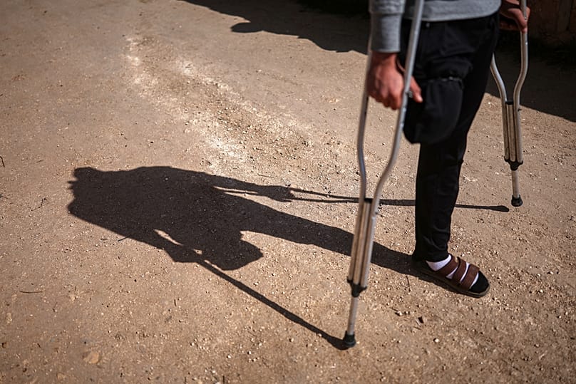 A Syrian man who lost his leg in a landmine explosion while harvesting olives walks outside his home in Qaminas, 9 April, 2025