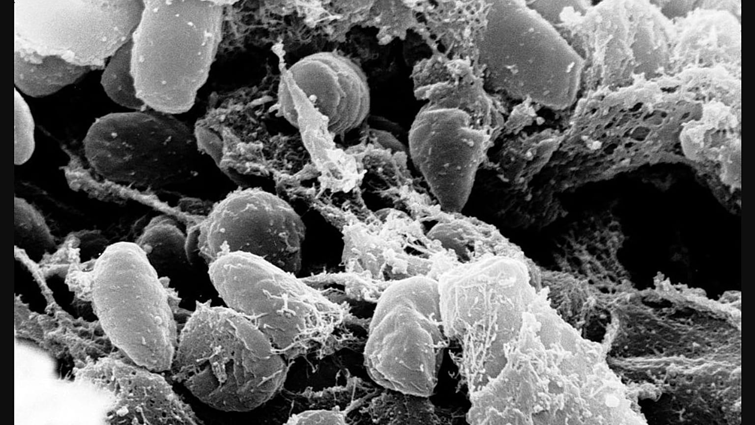 Yersinia pestis bakterisinin mikroskop altında görüntüsü