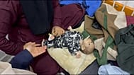 طفل فلسطيني مصاب بسوء التغذية في أحد مستشفيات غزة