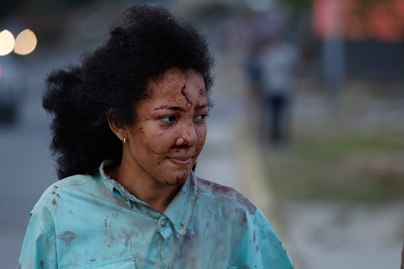 Una mujer herida camina por La Guaira, Venezuela, un día después del terremoto que azotó la zona, el jueves 25 de junio de 2026. (AP Photo/Pedro Mattey)