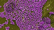Bacterias resistentes a los antibióticos. 