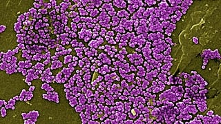 Bacterias resistentes a los antibióticos. 