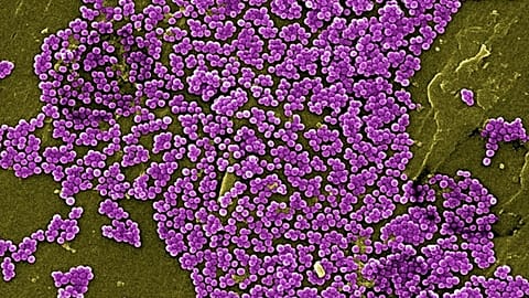 Antibiotic-resistant bacteria.