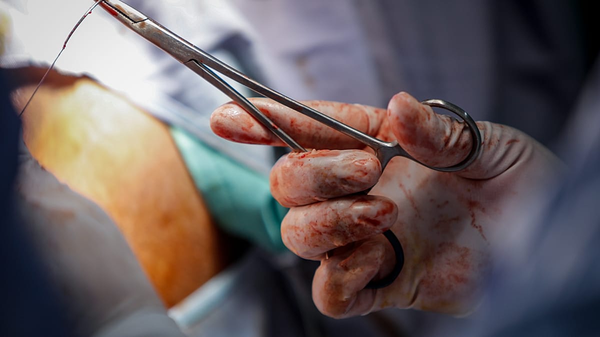 Mutilación genital femenina: 292 casos identificados en Portugal el año pasado