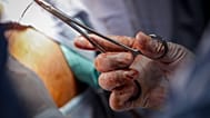 Médicos realizam uma cirurgia de reparação numa doente que tinha sido anteriormente submetida a mutilação genital feminina (MGF), na Somália, 8 de fevereiro de 2022 