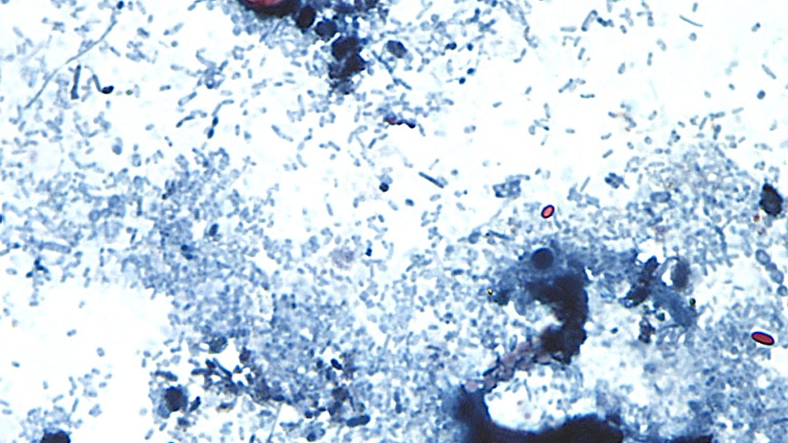 تم التقاطها من خلال المجهر الذي قدمه مركز السيطرة على الأمراض بويضات Cyclospora cayetanensis الموجودة في عينة براز طازجة تم تحضيرها بمحلول الفورمالين وصبغها بالسافرانين