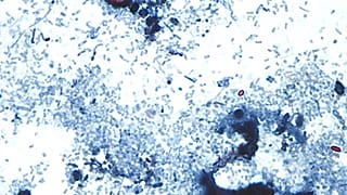 تم التقاطها من خلال المجهر الذي قدمه مركز السيطرة على الأمراض بويضات Cyclospora cayetanensis الموجودة في عينة براز طازجة تم تحضيرها بمحلول الفورمالين وصبغها بالسافرانين