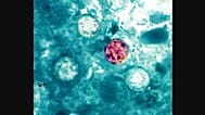 Cyclospora parazitinin mikroskop altında görünümü.