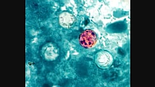 Cyclospora parazitinin mikroskop altında görünümü.