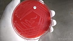 Laboratuvarda petri kabında listeria bakterisi.