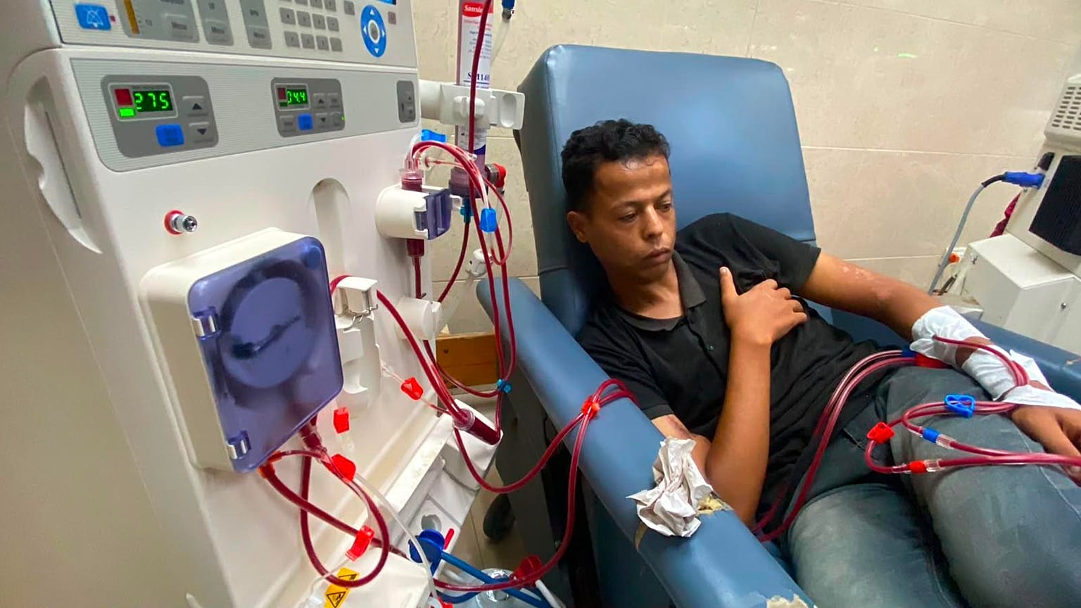 مريض فلسطيني أثناء جلسة غسيل كلوي في مستشفى شهداء الأقصى بمدينة دير البلح وسط قطاع غزة  