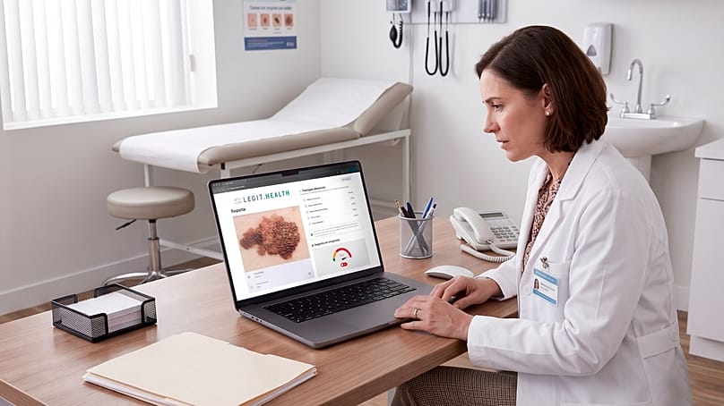 منصة Legit.Health للأطباء، تعرض حالة ميلانوما