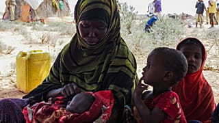 MSF warns of worsening malnutrition crisis among displaced children in Somalia