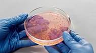 L'étude, publiée jeudi dans Nature Microbiology, suggère que ces régions aident les phages à diversifier leurs stratégies évolutives face aux défenses bactériennes.