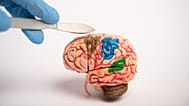 Traumatic brain injuries affect up to 69 million people annually. Such injuries can lead to post-traumatic epilepsy. 