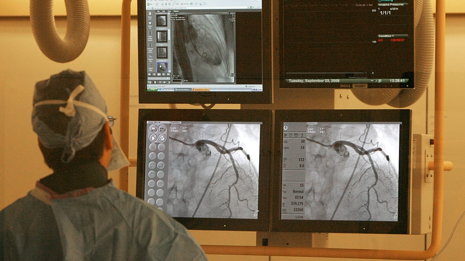 Dr. Harold Dauerman monitorokat ellenőrzi egy katéterezési laboratóriumi szívműtét során Burlingtonban, az egyesült államokbeli Vermont államban, 2008. szeptember 23-án