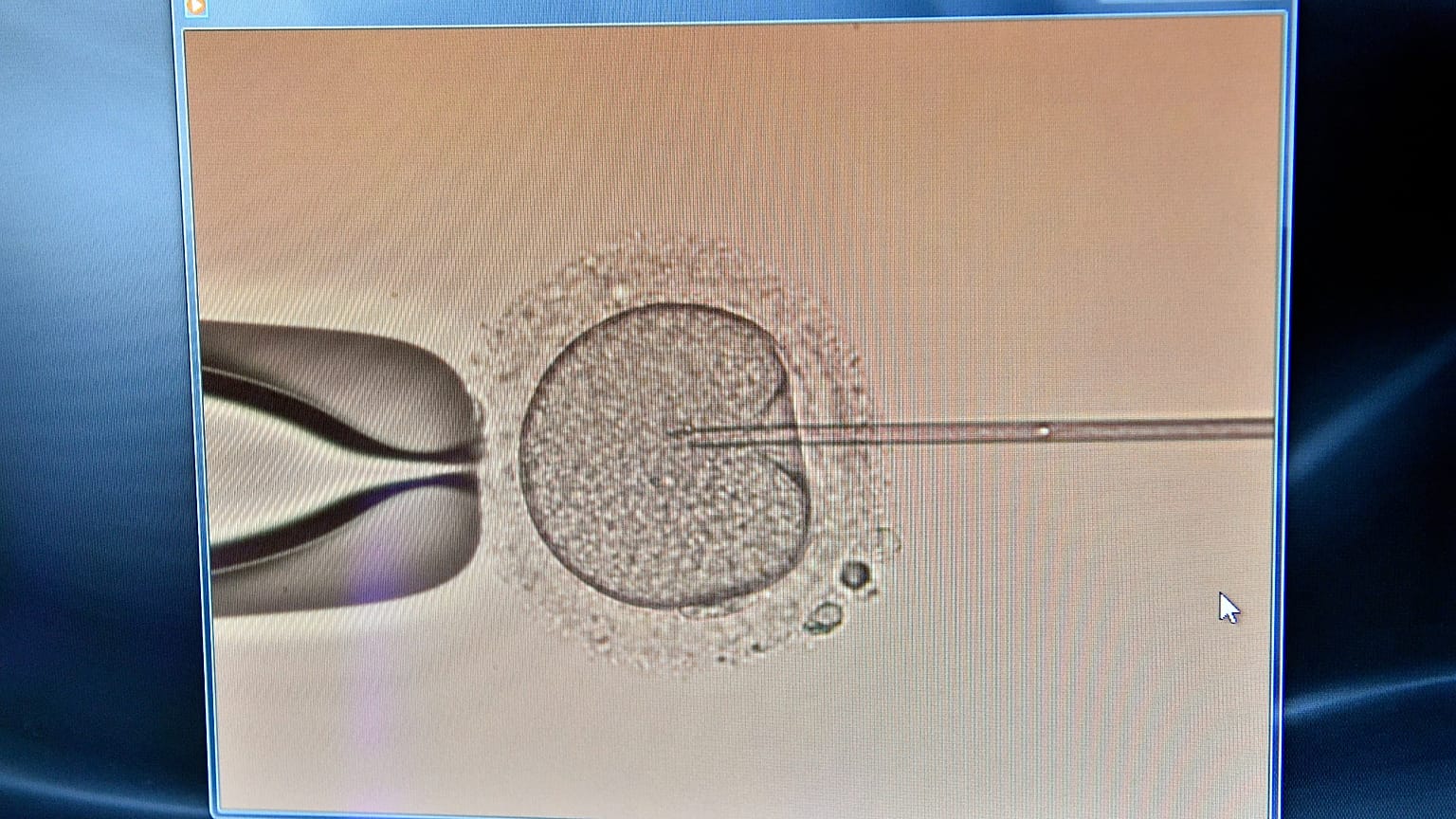 Mesterséges megtermékenyítés a Kaáli Intézet laboratóriumában - Budapest, 2017. május 26.