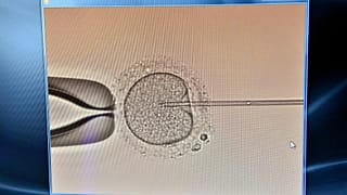 Mesterséges megtermékenyítés a Kaáli Intézet laboratóriumában - Budapest, 2017. május 26.