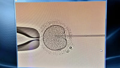 Mesterséges megtermékenyítés a Kaáli Intézet laboratóriumában - Budapest, 2017. május 26.
