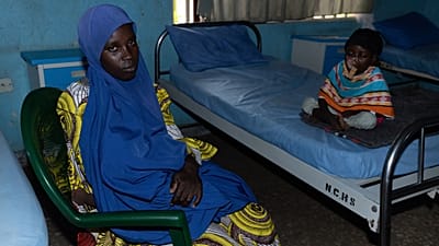 Noma: The neglected disease devastating children in northern Nigeria
