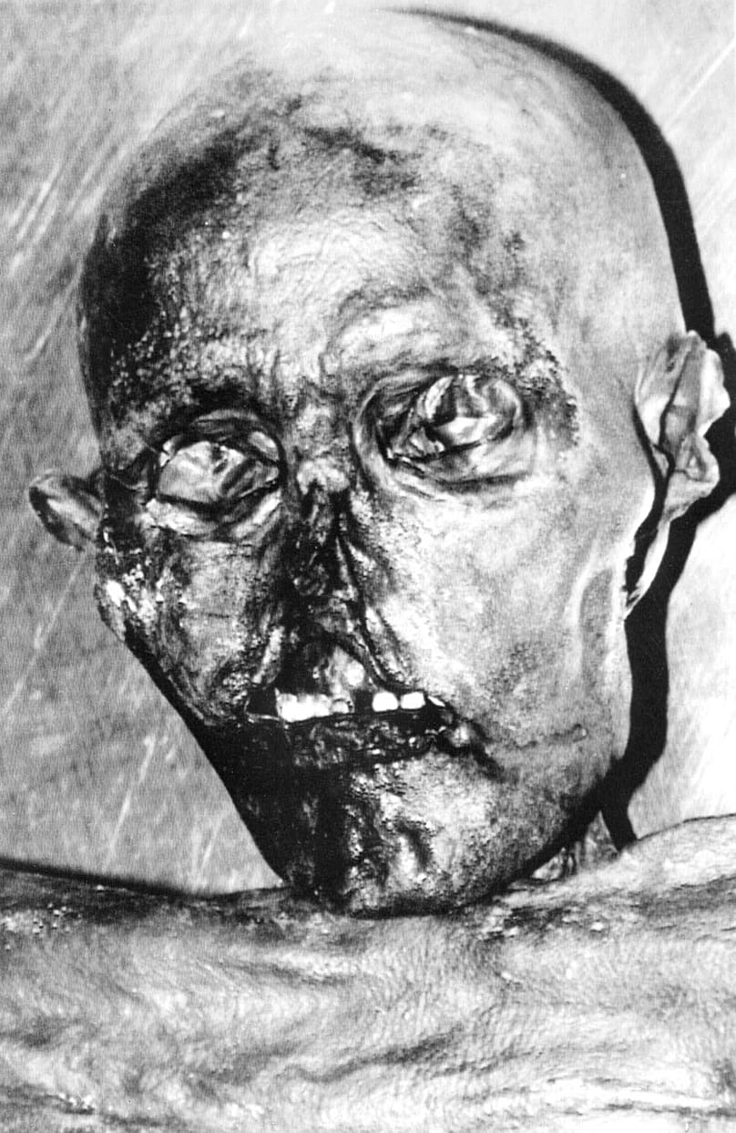 Ötzi