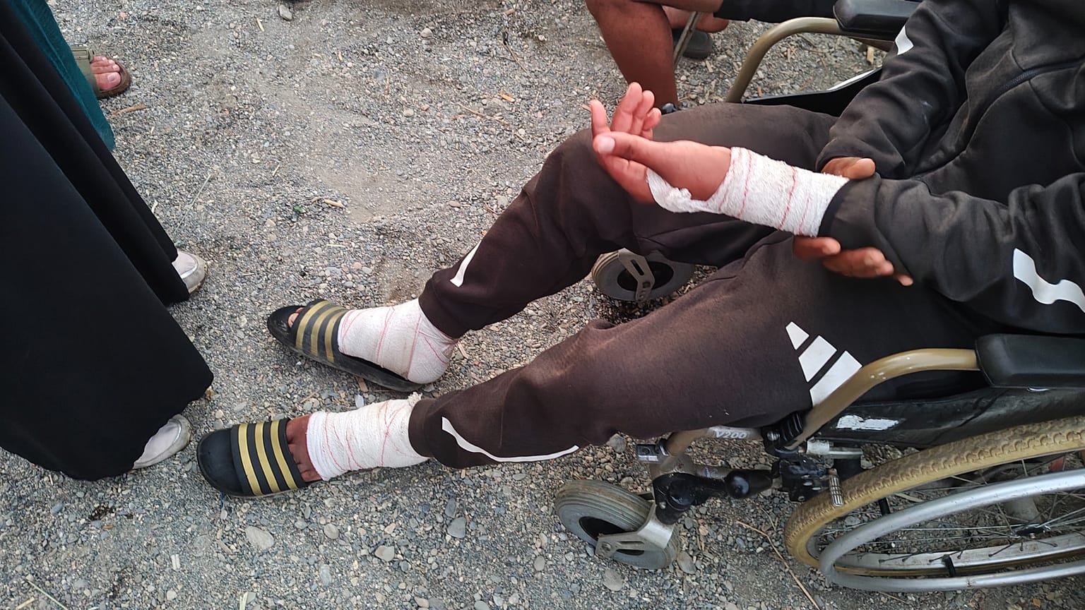 Imagen de las lesiones de un migrante herido. 