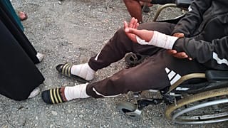 Imagen de las lesiones de un migrante herido. 