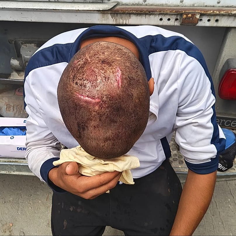 Un inmigrante con una lesión en la cabeza.
