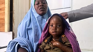 Somalie : la malnutrition infantile s’aggrave sur fond de crise humanitaire